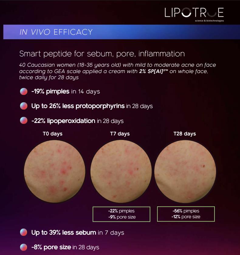 Inolab Derma ra mắt kem mụn không acid: Giải pháp hiệu quả cho làn da mụn nhạy cảm- Ảnh 3.