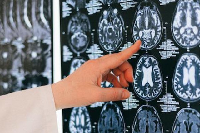 Dấu hiệu xuất hiện khi thức dậy cảnh báo sức khỏe đang kiệt quệ, đột quỵ, ung thư 'gõ cửa'- Ảnh 4. Dấu hiệu xuất hiện khi thức dậy cảnh báo sức khỏe đang kiệt quệ, đột quỵ, ung thư 'gõ cửa'- Ảnh 4.