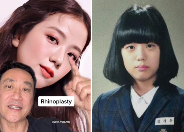 Tranh cãi bùng nổ bác sĩ khẳng định BLACKPINK phẫu thuật thẩm mỹ, ý kiến chủ quan không có bằng chứng xác thực? - Ảnh 7.