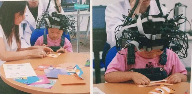 Bộ phận này chính là “bộ não thứ hai của cơ thể con người”: Cha mẹ nắm bắt sớm, con thông minh vượt trội- Ảnh 1. Bộ phận này chính là “bộ não thứ hai của cơ thể con người”: Cha mẹ nắm bắt sớm, con thông minh vượt trội- Ảnh 1.