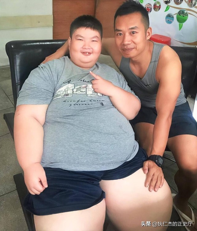 "Cậu bé nặng nhất Trung Quốc" 14 tuổi đã 150kg, có thể ăn 1 thùng mì gói 1 ngày có kết cục ra sao?- Ảnh 4.