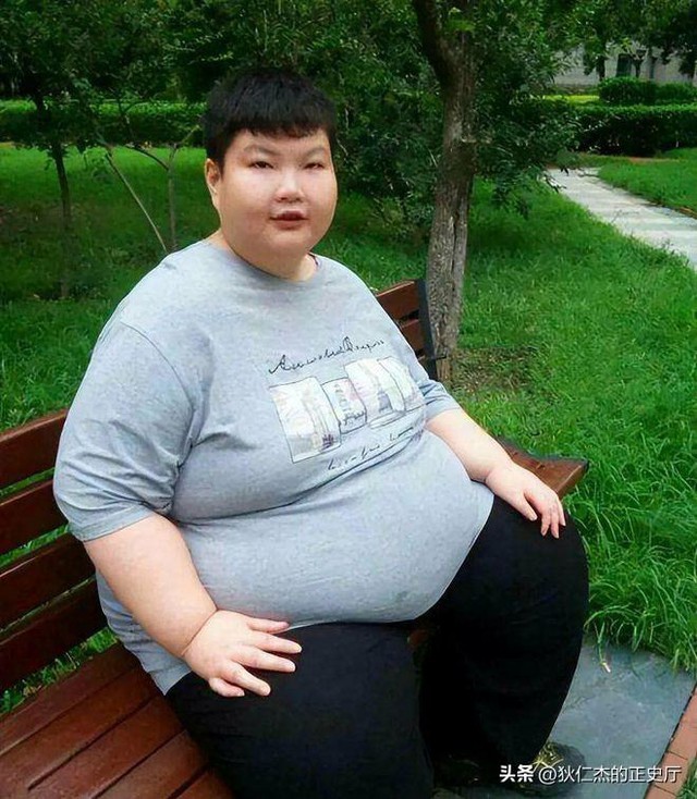 "Cậu bé nặng nhất Trung Quốc" 14 tuổi đã 150kg, có thể ăn 1 thùng mì gói 1 ngày có kết cục ra sao?- Ảnh 3.