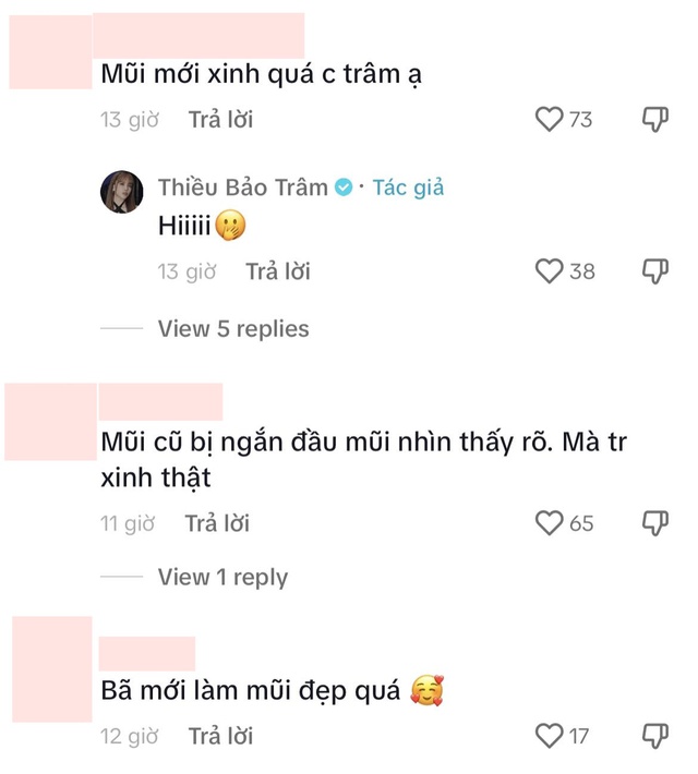 Thiều Bảo Trâm lộ diện mạo lạ hoắc, phản ứng đáng chú ý khi bị nghi vừa sửa mũi- Ảnh 5.