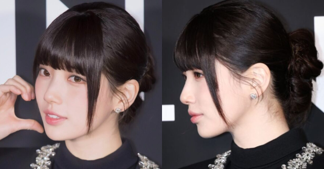Hình ảnh gây sốc của Suzy trước khi phẫu thuật- Ảnh 4. Hình ảnh gây sốc của Suzy trước khi phẫu thuật- Ảnh 4.