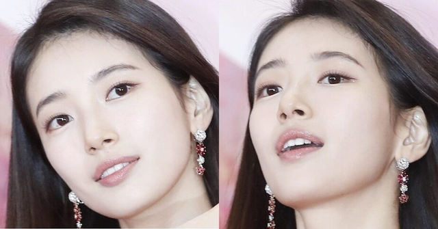 Hình ảnh gây sốc của Suzy trước khi phẫu thuật- Ảnh 5. Hình ảnh gây sốc của Suzy trước khi phẫu thuật- Ảnh 5.