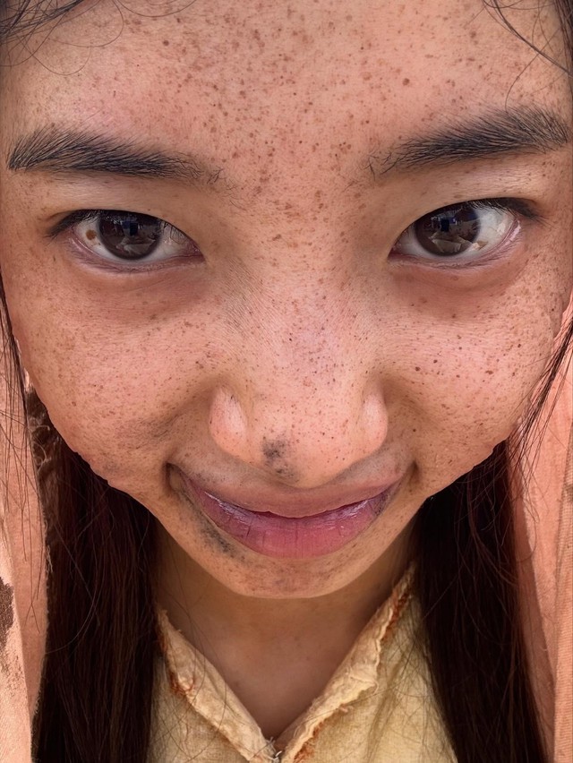 Hình ảnh gây sốc của Suzy trước khi phẫu thuật- Ảnh 1. Hình ảnh gây sốc của Suzy trước khi phẫu thuật- Ảnh 1.