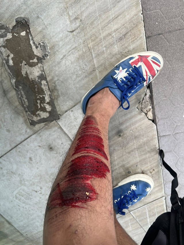 Quách Ngọc Tuyên bị tai nạn- Ảnh 1. Quách Ngọc Tuyên bị tai nạn- Ảnh 1.