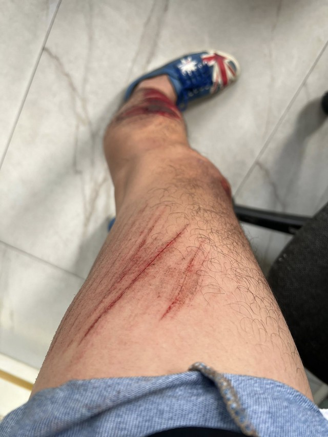 Quách Ngọc Tuyên bị tai nạn- Ảnh 2. Quách Ngọc Tuyên bị tai nạn- Ảnh 2.