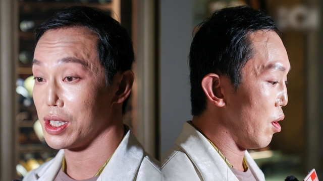 "Hoàng tử showbiz" bị vỡ nát gương mặt, phẫu thuật hơn 10 lần để sửa dung mạo méo mó biến dạng- Ảnh 1.