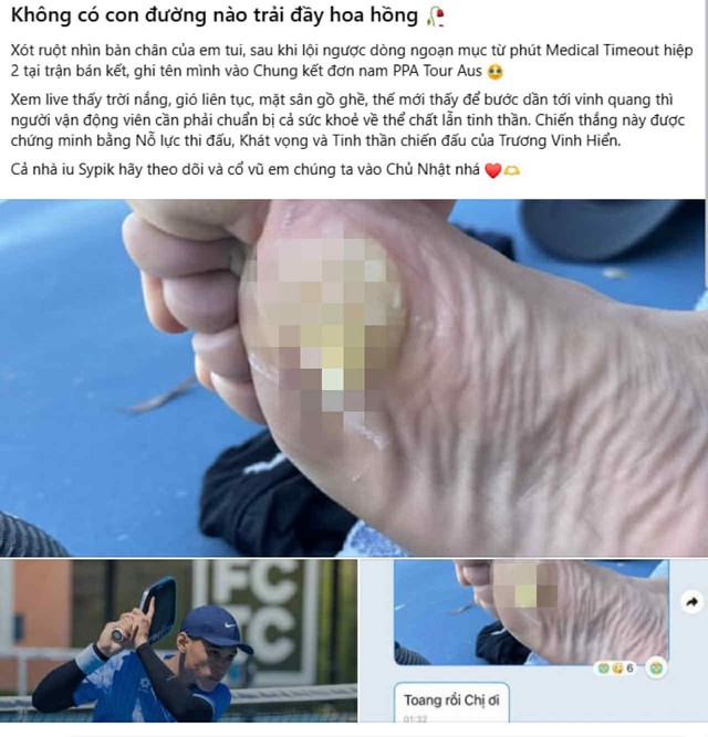 Xót xa bàn chân phồng rộp của Trương Vinh Hiển- Ảnh 1.