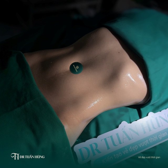 Bác sĩ Phạm Tuấn Hùng nói về "nghệ thuật" điêu khắc body- Ảnh 4.