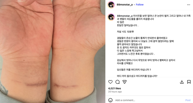 Sốc: Chủ nhân “bản hit quốc dân” cố tự tử- Ảnh 2.