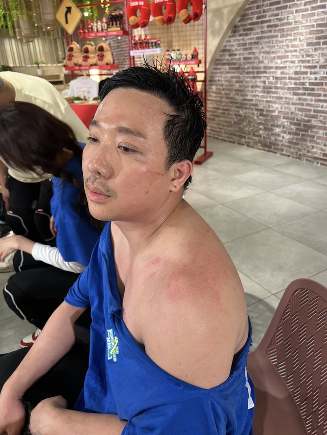 Chưa bao giờ thấy Trấn Thành tơi tả đến mức độ này- Ảnh 5. Chưa bao giờ thấy Trấn Thành tơi tả đến mức độ này- Ảnh 5.