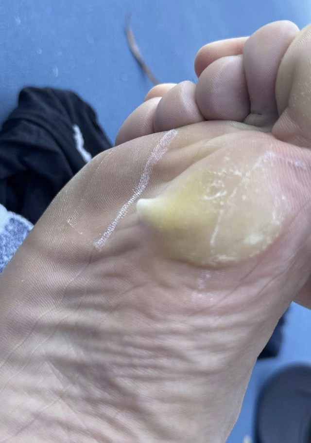 Từ thất vọng của PPA Úc mới thấy Việt Nam là "thiên đường Pickleball" không chỉ ở châu Á- Ảnh 3. Từ thất vọng của PPA Úc mới thấy Việt Nam là "thiên đường Pickleball" không chỉ ở châu Á- Ảnh 3.