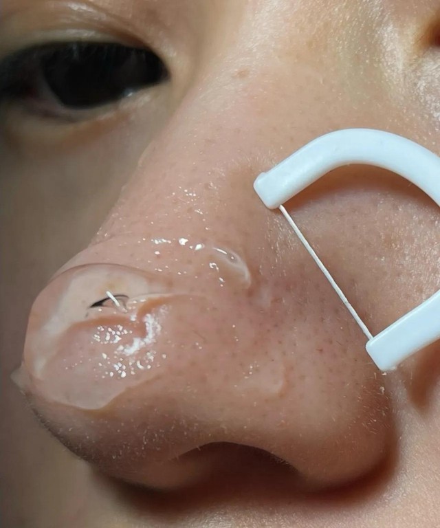 Món đồ bác sĩ khuyên dùng: Công dụng "đỉnh nóc", muốn chung thủy cả đời- Ảnh 8.