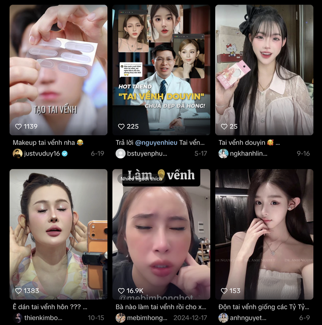 Cô gái khổ sở 30 năm vì tai giống Đoàn Di Băng- Ảnh 6.