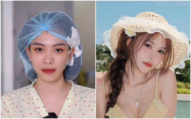 Gương mặt trước khi đụng dao kéo của dàn "búp bê thẩm mỹ"- Ảnh 3.