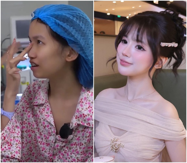 Gương mặt trước khi đụng dao kéo của dàn "búp bê thẩm mỹ"- Ảnh 8.