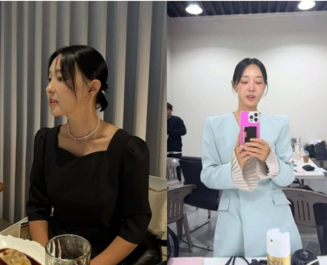 Mỹ nhân phim giờ vàng liều lĩnh "dao kéo" thu ngắn nhân trung, giờ gánh di chứng đến suốt đời- Ảnh 2. Mỹ nhân phim giờ vàng liều lĩnh "dao kéo" thu ngắn nhân trung, giờ gánh di chứng đến suốt đời- Ảnh 2.