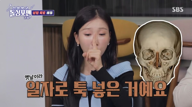 Chưa từng có tiền lệ: Sao nữ “dao kéo” công khai ảnh chụp CT silicon trong mũi trên sóng truyền hình- Ảnh 2. Chưa từng có tiền lệ: Sao nữ “dao kéo” công khai ảnh chụp CT silicon trong mũi trên sóng truyền hình- Ảnh 2.