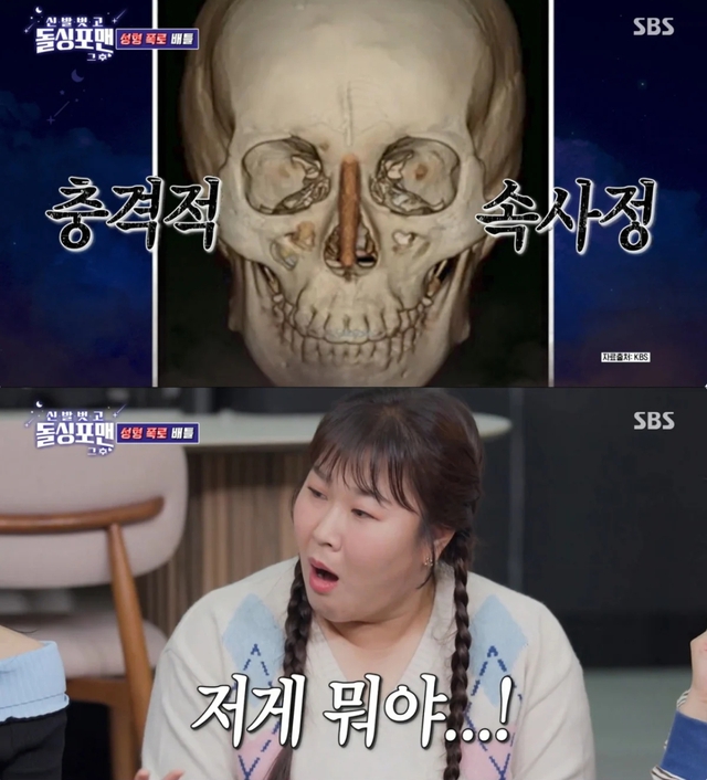 Chưa từng có tiền lệ: Sao nữ “dao kéo” công khai ảnh chụp CT silicon trong mũi trên sóng truyền hình- Ảnh 3. Chưa từng có tiền lệ: Sao nữ “dao kéo” công khai ảnh chụp CT silicon trong mũi trên sóng truyền hình- Ảnh 3.