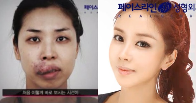 Cô gái vô danh khiến cả showbiz sững sờ với màn "vịt hoá thiên nga" thành mỹ nhân đẹp như búp bê - Ảnh 2.