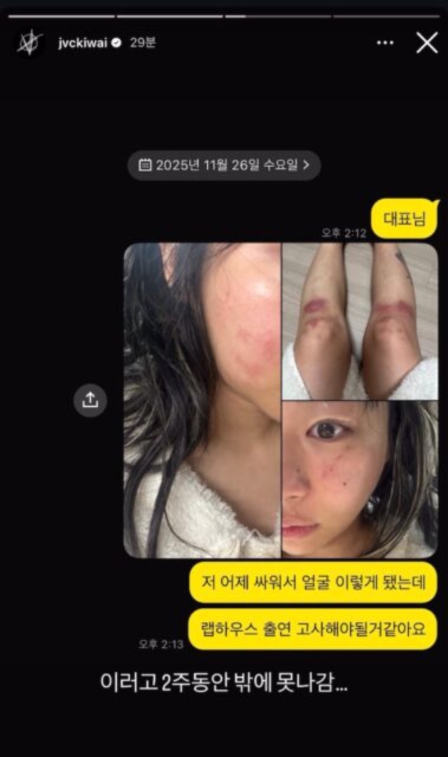 Nữ rapper 96 tung ảnh bị bạn trai đánh bầm dập đến mức hủy show, đàng trai hùng hổ phốt ngược gây phẫn nộ- Ảnh 2. Nữ rapper 96 tung ảnh bị bạn trai đánh bầm dập đến mức hủy show, đàng trai hùng hổ phốt ngược gây phẫn nộ- Ảnh 2.