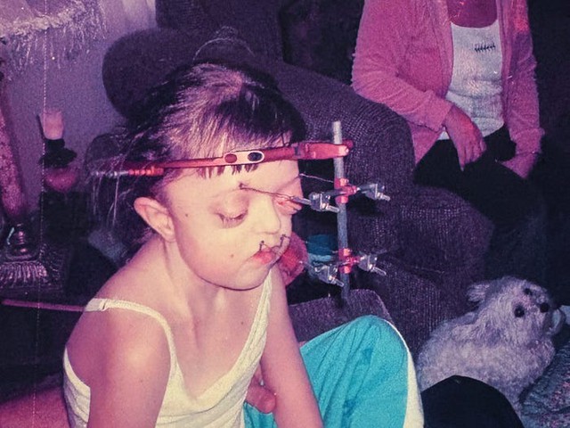 Tôi đã che giấu khuôn mặt suốt nhiều năm, nhưng giờ tôi tự hào chấp nhận vẻ khác biệt của chính mình- Ảnh 3. Tôi đã che giấu khuôn mặt suốt nhiều năm, nhưng giờ tôi tự hào chấp nhận vẻ khác biệt của chính mình- Ảnh 3.