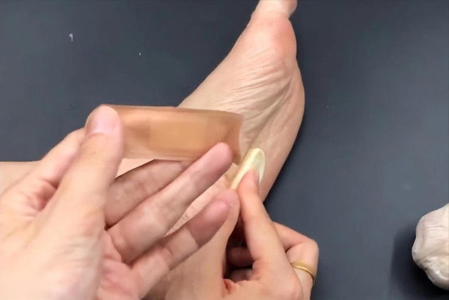 Người phụ nữ 56 tuổi dán tỏi vào lòng bàn chân suốt 6 tháng, kết quả khám sức khỏe khiến bác sĩ "ngã ngửa"- Ảnh 1.