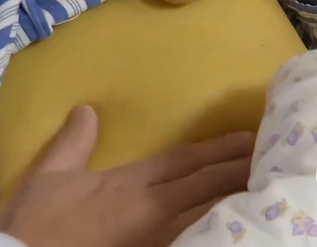 Nữ sinh 20 tuổi suy gan, da vàng như nghệ vì chăm da theo cách của nhiều người- Ảnh 1.