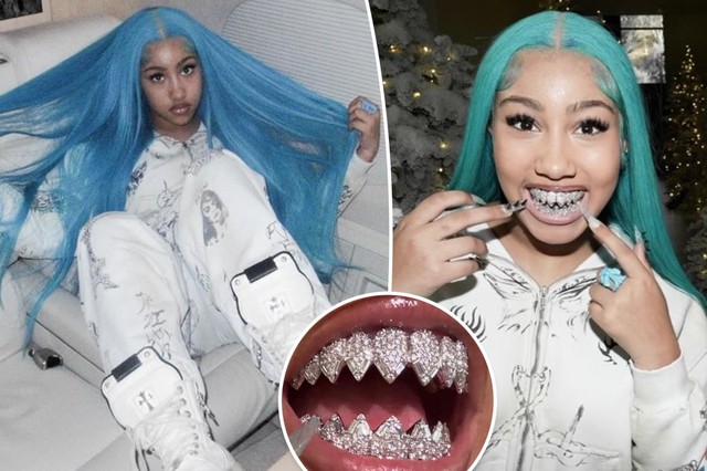 Ái nữ triệu đô North West 12 tuổi làm răng kim cương: Cá tính nghệ thuật hay sự chín ép của hào quang nổi tiếng?- Ảnh 1.