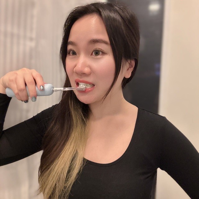 Cận cảnh thứ bên trong của bàn chải điện khiến nhiều người rùng mình: BS nói gì?- Ảnh 3.