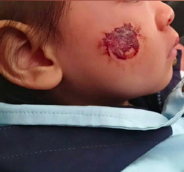 Bé gái 3 tuổi bị bỏng rộp cả mặt vì “miếng dán đồ chơi”: Nhiều đồ chơi hot trên mạng tuyệt đối không mua- Ảnh 1.