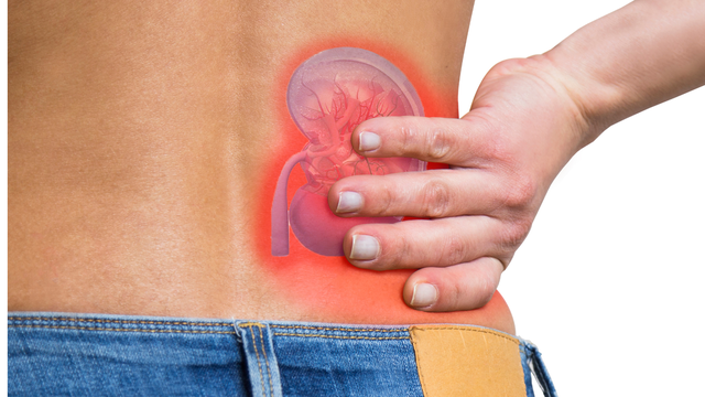 Người đàn ông 32 tuổi phát hiện ung thư thận nhờ làm 1 việc vào tháng 9- Ảnh 3.