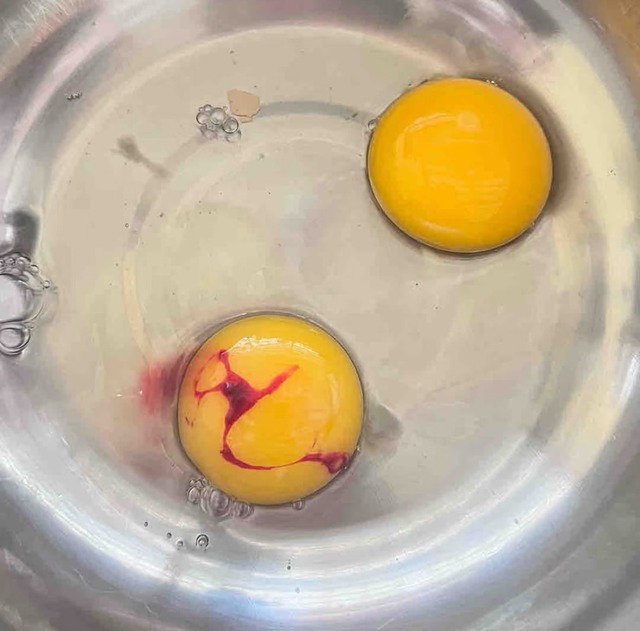 Có 2 loại trứng trong "danh sách đen" dễ gây hại sức khỏe, thèm đến mấy cũng phải VỨT!- Ảnh 5.