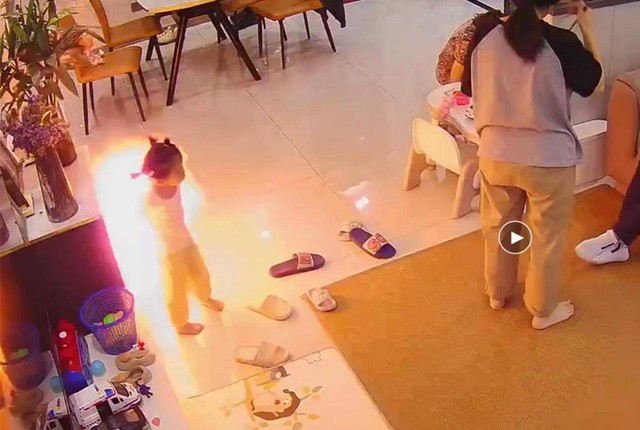 Bóng bay phát nổ khiến bé gái bị cháy sém tóc, người mẹ đăng đàn cảnh báo phụ huynh không nên mua loại bóng này- Ảnh 3.
