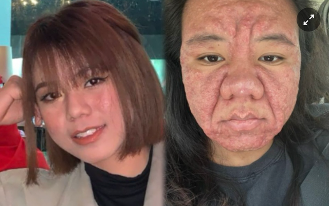 Gương mặt thay đổi khó tin vì mang thai: Hành trình làm mẹ của cô gái 28 tuổi khiến nhiều người xót xa- Ảnh 1.
