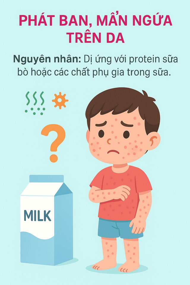 MẸ CẦN BIẾT: Con uống sữa mà có 5 dấu hiệu này thì cần đổi sữa cho con ngay!- Ảnh 5.