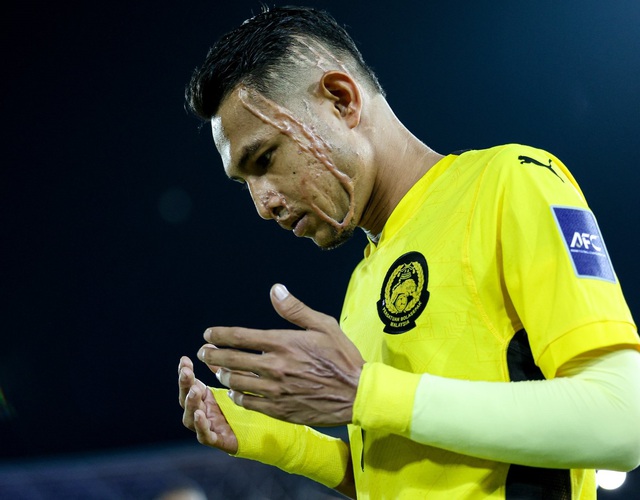 Tâm sự đau lòng của cầu thủ được ví như Ronaldo bị tạt axit gây rúng động: “Tôi không thể cười bình thường được nữa”- Ảnh 1.