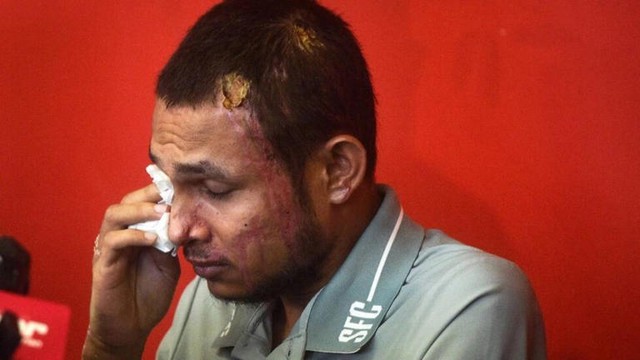 Tâm sự đau lòng của cầu thủ được ví như Ronaldo bị tạt axit gây rúng động: “Tôi không thể cười bình thường được nữa”- Ảnh 2.