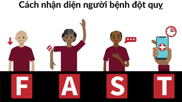 Ngày càng nhiều người trẻ bị đột quỵ: Cảnh báo những dấu hiệu đột quỵ khi ngủ, người khỏe mạnh cũng không được chủ quan- Ảnh 3.