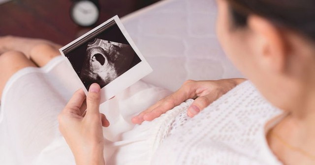 Tuần thai thứ 7: Thai phát triển nhanh, tay chân bé bắt đầu hình thành- Ảnh 8. Tuần thai thứ 7: Thai phát triển nhanh, tay chân bé bắt đầu hình thành- Ảnh 8.