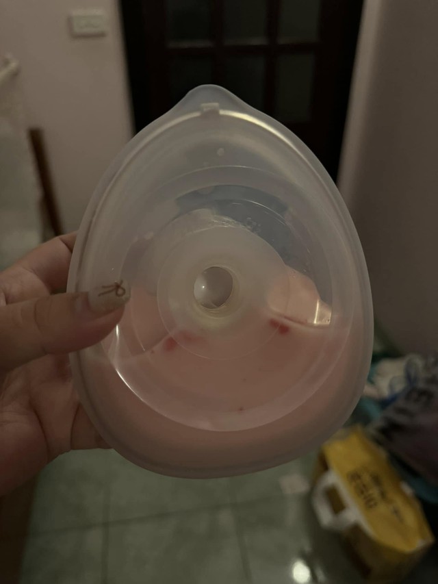 Sự tích "bình sữa dâu": Những hình ảnh nhìn đã thấy đau đớn, vậy mà các mẹ chỉ thấy tiếc của vì phải đổ đi- Ảnh 8.