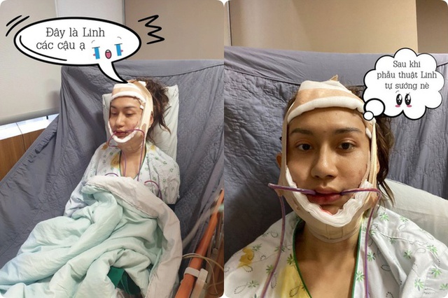 Nam ca sĩ trải qua 8 ca phẫu thuật để thành "gái xịn", được Đen Vâu bảo vệ khi bị châm biếm- Ảnh 3.