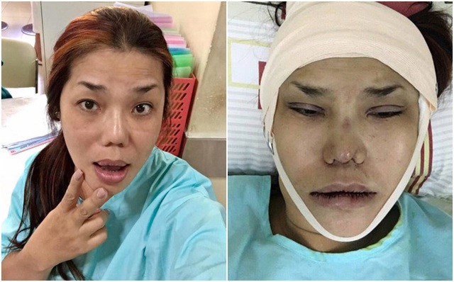 Sao Vbiz bị rối loạn tinh thần sau khi phẫu thuật chuyển giới, suy sụp vì chồng mất do u não- Ảnh 7.