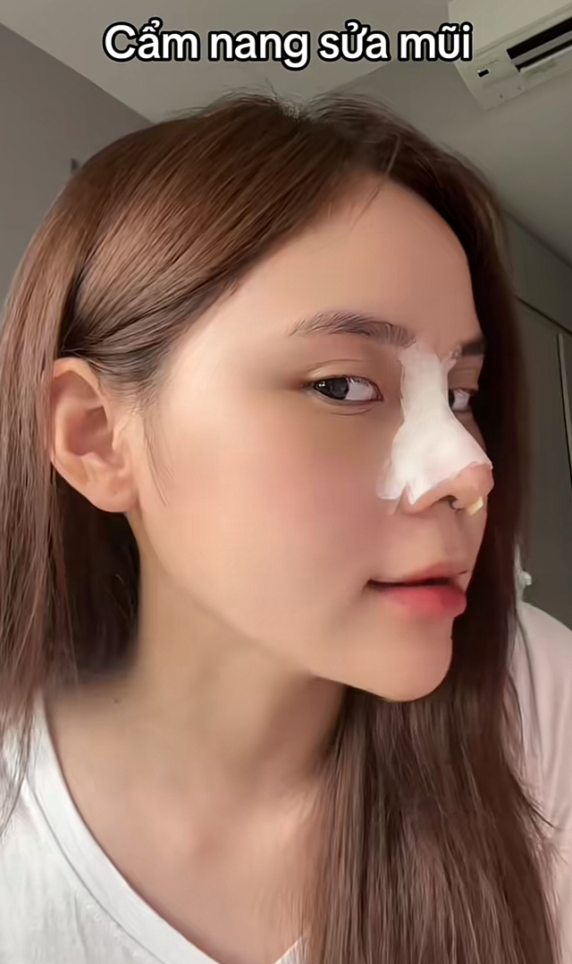 Hậu phẫu thuật thẩm mỹ, "bạn thân" Trần Hà Linh khiến fan ngỡ ngàng với nhan sắc lạ lẫm- Ảnh 4.