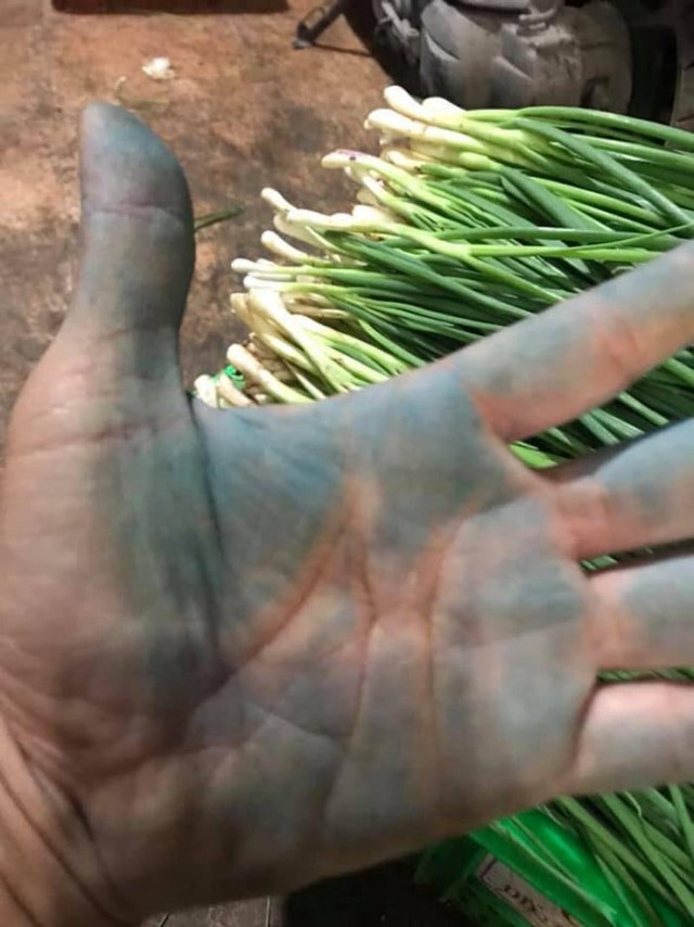 Người trong nghề chỉ ra 1 dấu hiệu tố cáo hành "ngậm" hóa chất, đi chợ đừng bị xanh mướt LỪA- Ảnh 4.