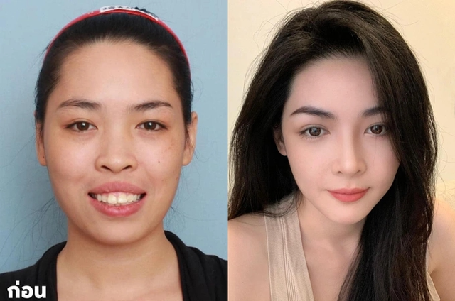5 cô gái Việt là "nhân chứng" cho sự thay đổi cuộc sống nhờ "dao kéo": Đẹp, giàu, bản sao Phạm Băng Băng- Ảnh 11.