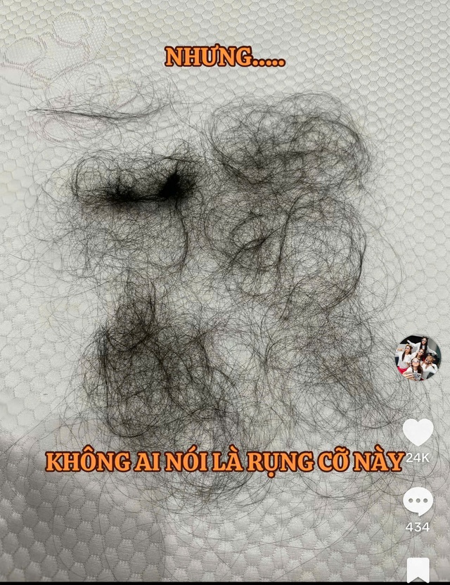 Puka gây lo lắng khi tóc rụng la liệt thành từng mảng sau khi sinh con đầu lòng- Ảnh 2.