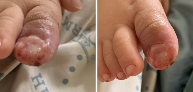 Con bị cục biến áp điện rơi vào chân đến biến dạng nhưng mẹ không dám cho đi khám vì bà ngoại mắng "thừa tiền"- Ảnh 3.